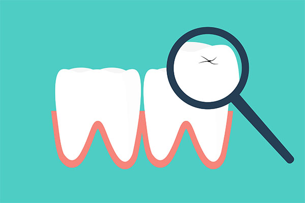 Four Tips for Making Your Dental Crowns Last from Cosmetic Dental Care of Santa Monica in Santa Monica, CA